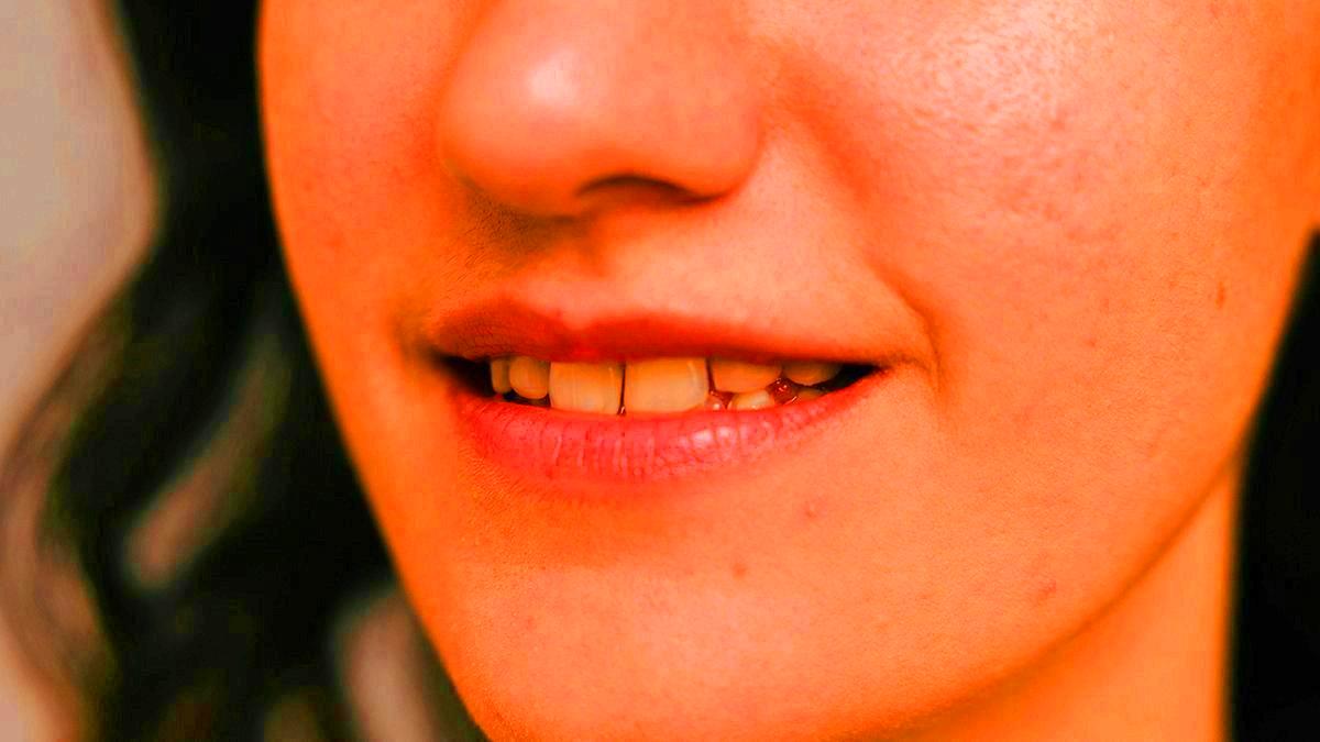 Fini les dents jaunes : trois astuces efficaces pour raviver la blancheur de votre sourire